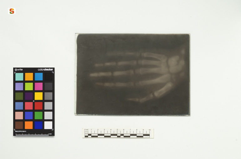 radiografia, su vetro (sec. XX)